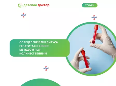 Определение РНК вируса гепатита С в крови методом ПЦР, качественный